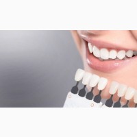 Записаться на отбеливание зубов в клинику Эстет Смайл